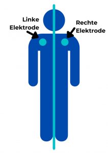 klebeelektroden-zapper-steramedig-b2